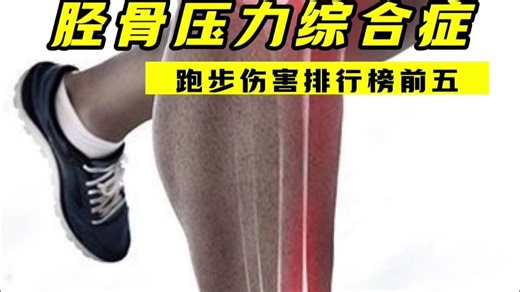 小腿胫骨痛 !?