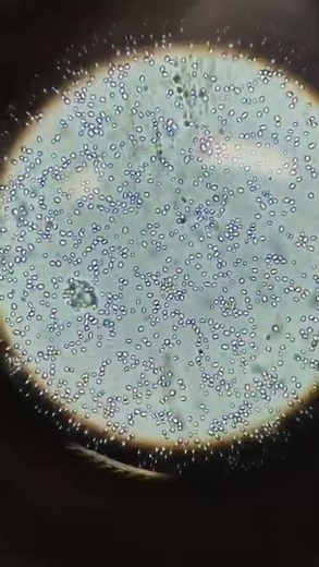 yeast under microscope