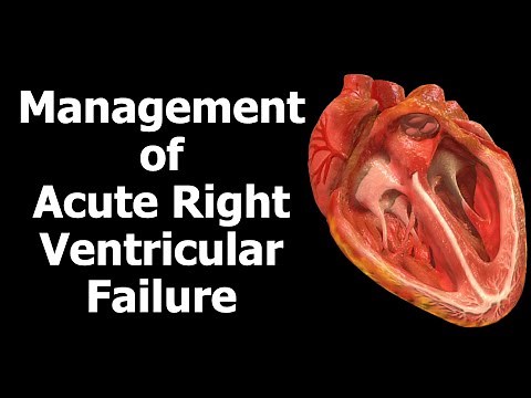 Management of Acute Right Ventricular Failure
