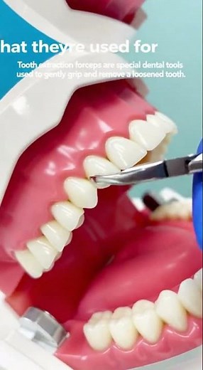 🦷 What Are Tooth Extraction Forceps—and How Do They Work?