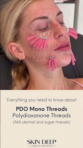 Everything you need to know about PDO Mono Threads 🪡