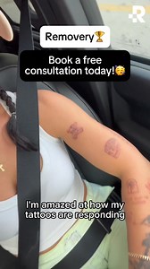 890K views · 11 reactions | Tattoo removal? Surprisingly tolerable. Cost? More affordable than you think. Experience the Removery difference — book now! | Removery | Facebook