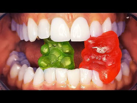 Why Do My Teeth Hurt When I Eat Sweets & Become Sensitive to Sugar? Dentin Hypersensitivity Pain!