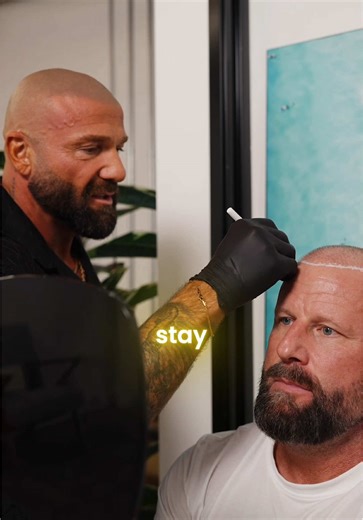 Choosing the right hairline for scalp micropigmentation #hairtattoo #scalptattoo #scalpmicropigmentation