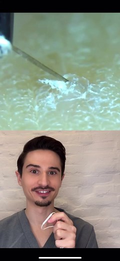 Dermatologist Reacts: How to Remove Ingrown Hair Safely