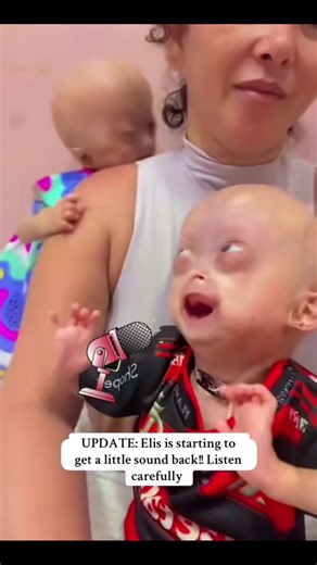 Listen carefully to Elis! She is starting to get some sound back to her voice!! 🙌🙌 #eliseeloa #progeria #linda #lifestyle #fyp