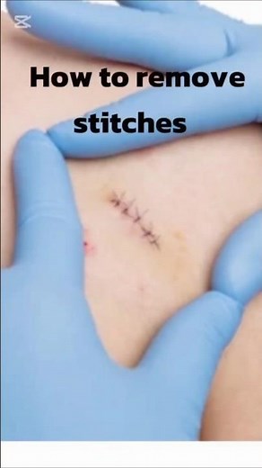 How to remove stitches **Step by step guide **#medicaleducation #suturingskills