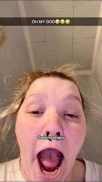 The Most Awkward Moment During My Colonoscopy😭#colonoscopy #hospital #awkward #embarrassing #funny