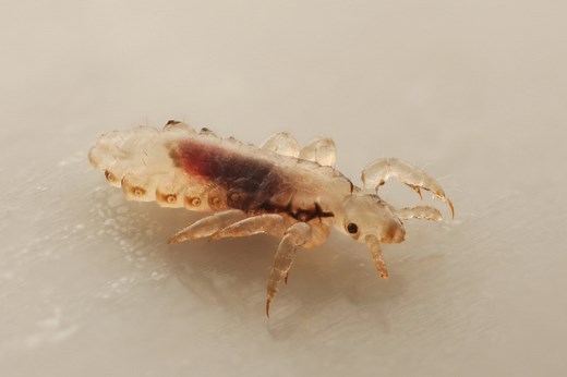 Where Do Lice Come From? | LiceDoctors