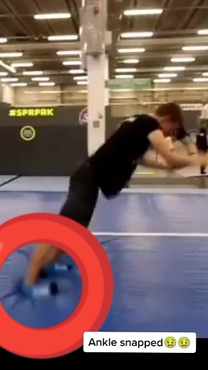 Broken ankle🤢 #fail #fails #hospital #acrobatics #backflip #flips #gymnast #gymnastics #trampoline #airtrack