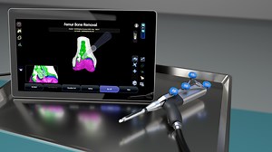 CORI surgical system - sportsmed