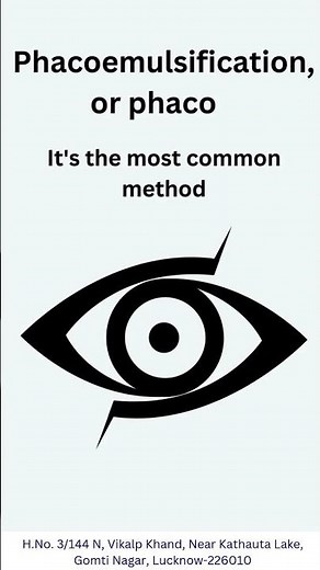 3 Types of Cataract Surgery Explained | Best Cataract Treatment for Clear Vision