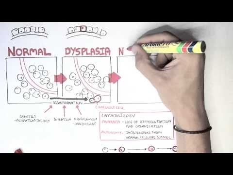 Cancer - Introduction II