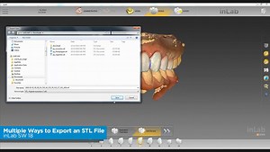 This week's #Techin2Min teaches you, 'Multiple Ways to Export an STL File" using our inLab SW 18. 🎥features Jay Black from Winter Springs Dental Lab. #Techin2Tuesday | Dentsply Sirona Lab