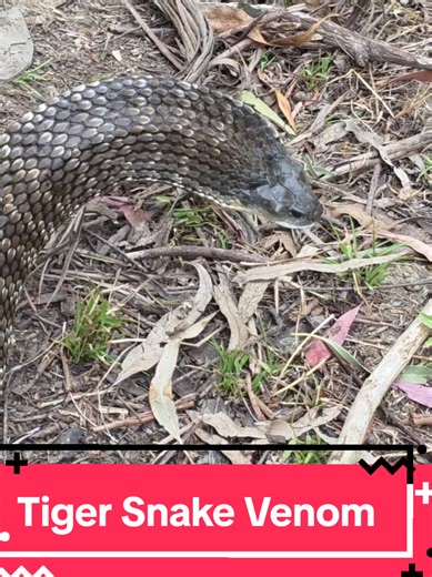 TIGER SNAKE VENOM - BY MARK PELLEY THE SNAKE HUNTER Tiger snake venom primarily causes venom induced consumption coagulopathy but also has neurotoxic effects and myotoxins. One single bite can kill many people so do NOT ever touch these snakes. In my next video Im going to discuss snake bite first aid. #snake #venom #venomous #snakehunter #toxic