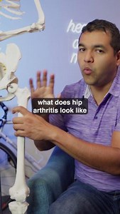 What does bone-on-bone hip arthritis actually means? Why does it happens? How do you treat it? 👀 #hiparthritis #hippain #hippainhelp #hiparthritishelp | El Paso Manual Physical Therapy