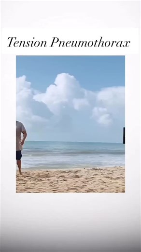 Medical insightX😷 | Tension pneumothorax is a life‑threatening emergency where air builds up in the pleural space, collapsing the lung and pushing the heart... | Instagram