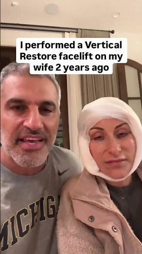Plastic Surgeon's Wife Gets a Facelift - 2 Year Vertical Restore Facelift Anniversary