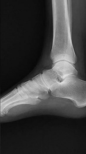 You can't interpret this X ray without knowing this