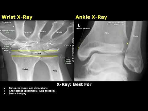 The Difference Between Ultrasound, X-Ray, CT Scan & MRI | How They Work, Advantages & Disadvantages
