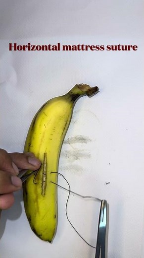 Horizontal Mattress Suture Technique | Step-by-Step Suturing Demonstration #surgery #suturing