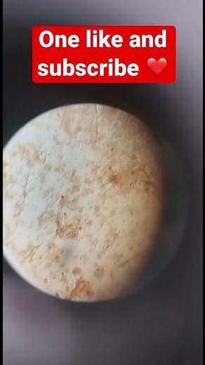 Vibrio Comma - cholera bacteria under microscope 😳 | Biology | Botany | Science Practical | #shorts