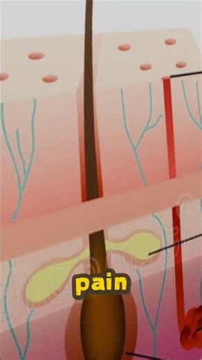 What happens when a splinter enters your skin? #shorts