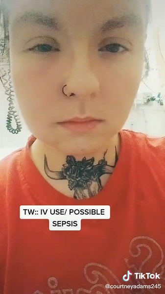 Posible sepsis y celulitis facial por problemas dentales