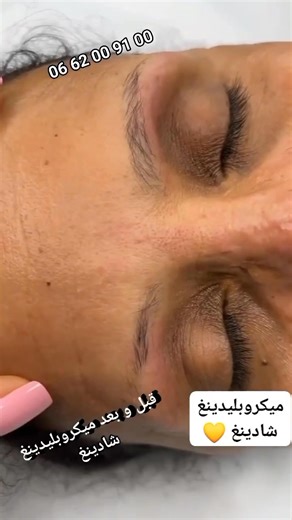 ميكزويلادينغ شادينغ Combomix | YouSsi Lotus