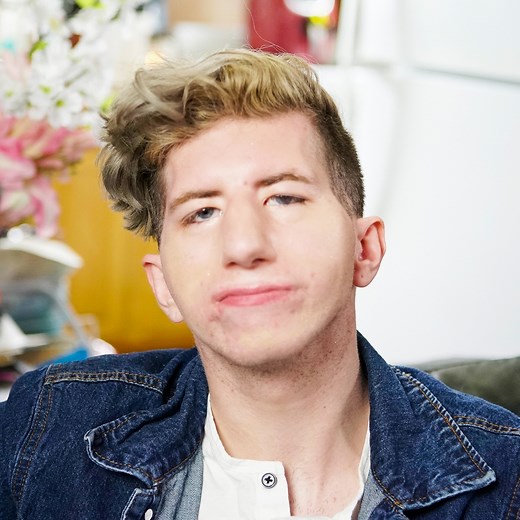 465K views · 2.8K reactions | My face is paralysed so I can't smile | Born Different | Facebook