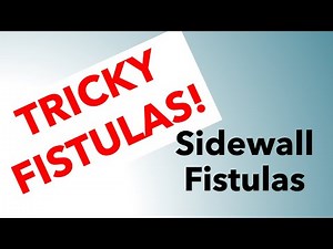 006 Sidewall Fistulas