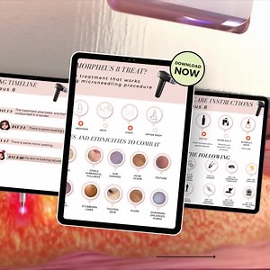 Morpheus8 Before Care & After Care Instruction Cards | Skincare Treatment Guidelines | Aesthetic Procedure Essentials | Instant Download - Etsy