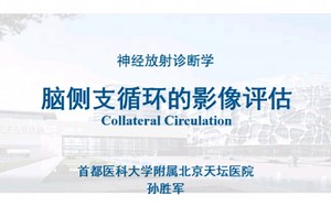 脑侧支循环的影像评估