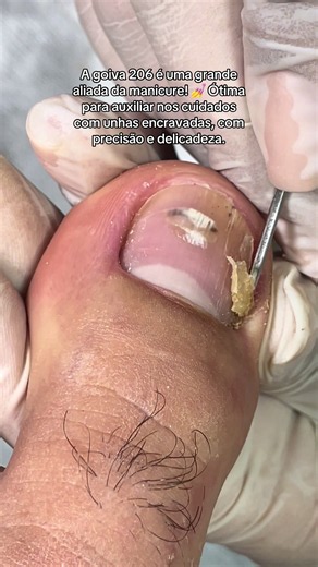 Se você trabalha com pedicure, precisa conhecer a goiva 206! Um instrumento que pode ajudar nos cuidados com os cantinhos das unhas, sempre com técnica e segurança. ❤️ #Goiva206 #Pedicure #ManicureProfissional #UnhasEncravadas #NailDesigner
