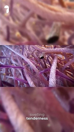 Part 1- Sculptra Side Effects & Safety: What You Need to Know Before Treatment