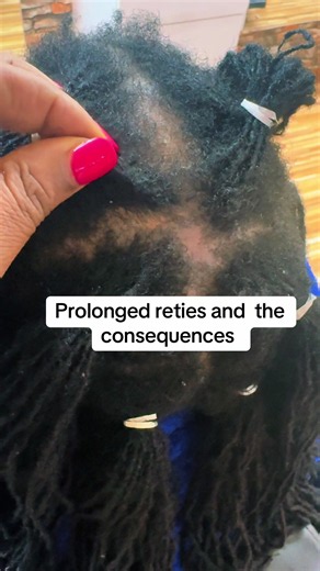 Sisterlocks: Risks of Prolonged Reties Explained