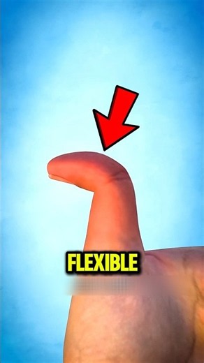 👍😱 Can Your Thumb Do THIS! You Might Have Hitchhiker’s Thumb!