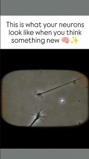 "Your Brain Cells in Action When You Learn Something New! 🧠💥 #facts #motivation