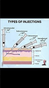 types of injections