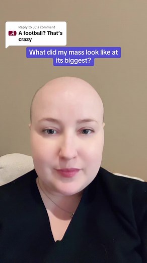 Understanding Sarcoma: What to Expect