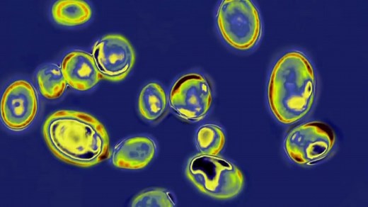 CDC warns of spike in U.S. cases of deadly fungal infection