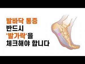 [족저근막염, 발바닥 통증] 반드시 '발가락'을 체크해야 합니다