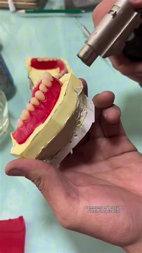 Making Removable Dentures: A Step-by-Step Guide