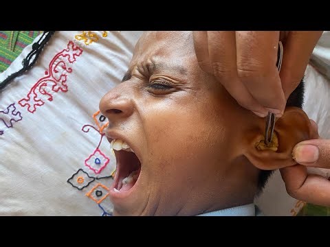 Gentle Ear Cleaning | Relaxing Care & Calming Sounds