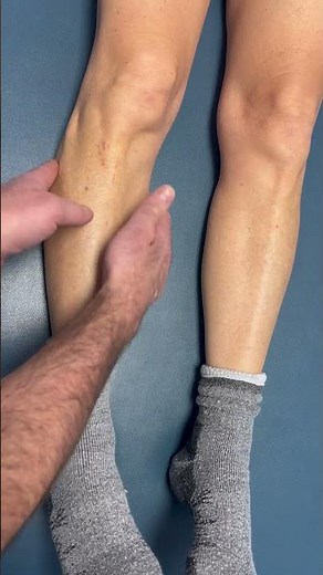 🔥Proximal tibio-fibular ligament tear. #kneeinjury #kneepain #physicaltherapy #athletictraining