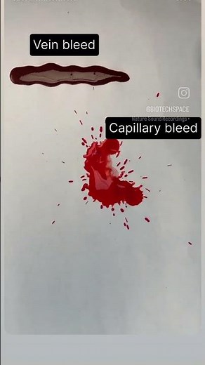 Different types of bleeding. arterial, venous, and capillary bleeding differences #biology #neet2026