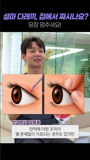 다래끼 집에서 압출? 최악의 대처법입니다 #다래끼 #다래끼치료 #다래끼압출 #다래끼짜기 #눈다래끼 #안과전문의 #눈건강 #건강정보 #쇼츠 #shorts