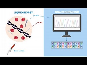 Liquid Biopsies: The Future of Cancer Detection and Monitoring