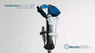 Here is a unique view of the Socket-less Socket™ for the above knee amputee. We call it the ConfigurationX (cX™). Its open design makes it breathable and cool, the adjustability makes for a perfect fit throughout the day, the soft conforming seat moves with your body so you can say goodbye to pinching and groin discomfort. We've said alot......now try it for yourself. | Martin Bionics
