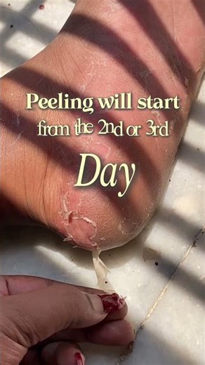 This foot peeling mask is breaking the internet 👀